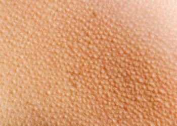 All you need to know about goosebumps