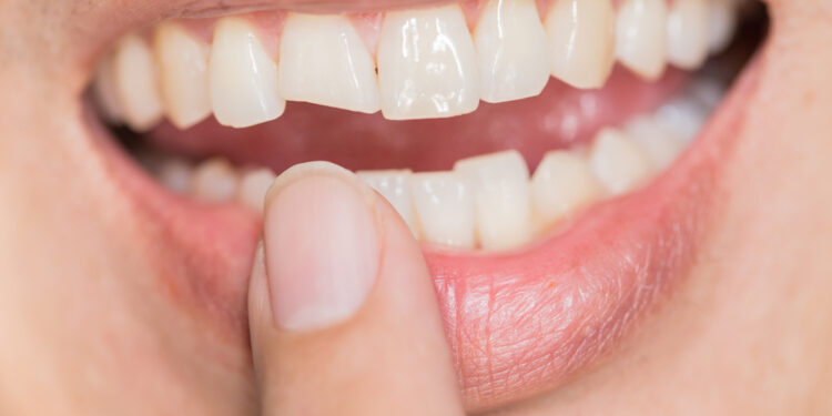 The secret author of your life story, your teeth